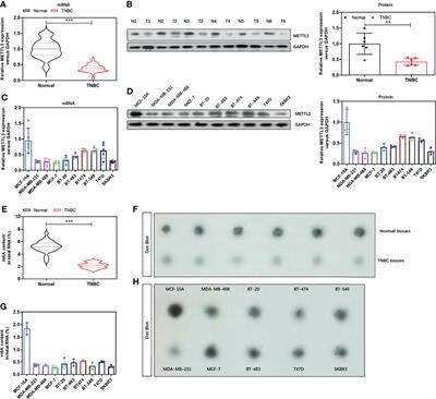 METTL3 Is Suppressed by Circular RNA circMETTL3/miR-34c-3p Signaling and Limits the Tumor Growth and Metastasis in Triple Negative Breast Cancer